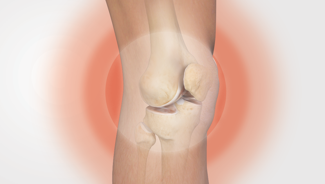 objectif thérapie hyalur arthrex